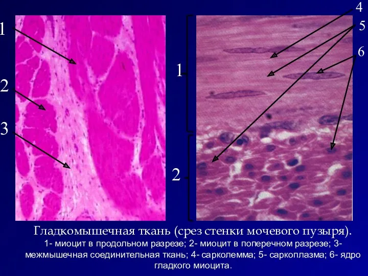 Гладкомышечная ткань (срез стенки мочевого пузыря). 1- миоцит в продольном разрезе; 2- миоцит