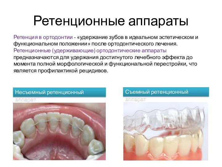 Ретенционные аппараты Ретенция в ортодонтии - «удержание зубов в идеальном эстетическом и функциональном