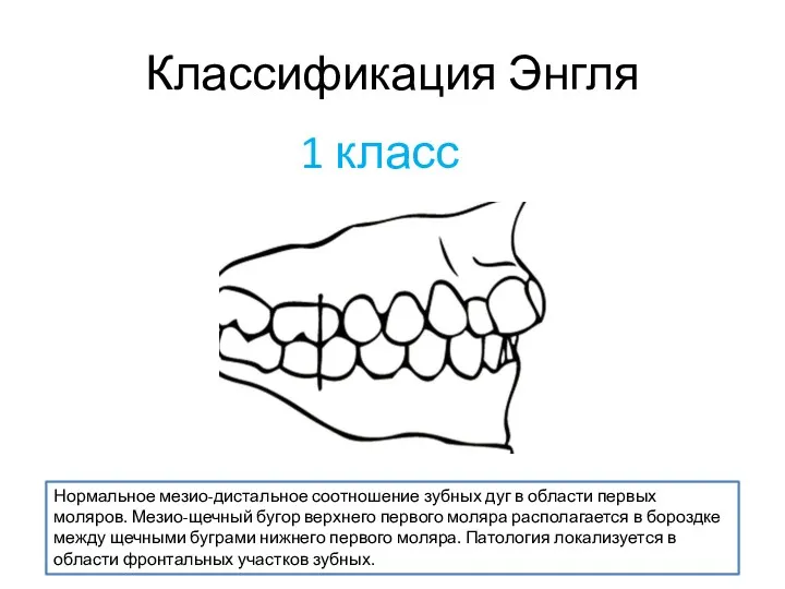 Классификация Энгля Нормальное мезио-дистальное соотношение зубных дуг в области первых