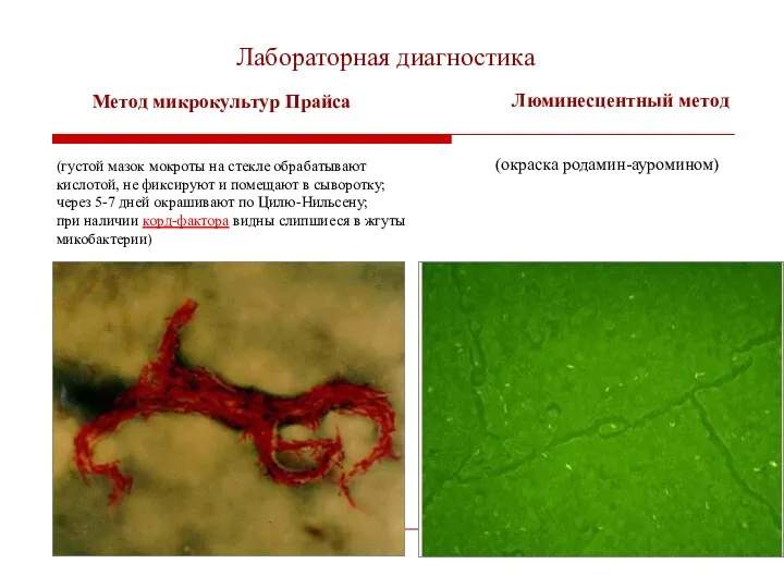 Лабораторная диагностика Метод микрокультур Прайса (густой мазок мокроты на стекле