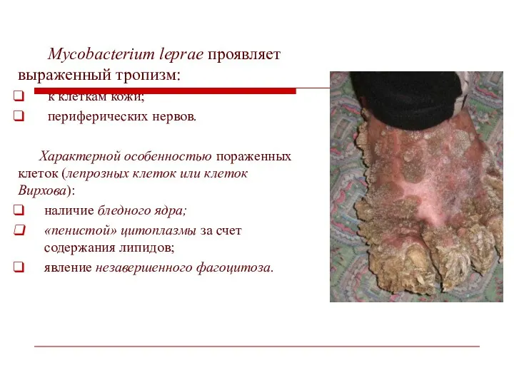 Mycobacterium leprae проявляет выраженный тропизм: к клеткам кожи; периферических нервов.