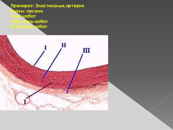 Препарат: Эластикалық артерия Бояуы: орсеин I.Ішкі қабат II.Ортаңғы қабат III.Сыртқы қабат