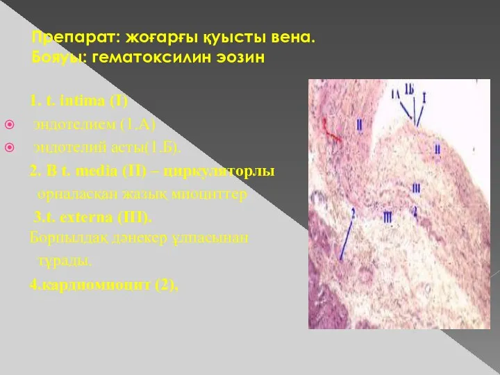 Препарат: жоғарғы қуысты вена. Бояуы: гематоксилин эозин 1. t. intima (I) эндотелием (1.А)