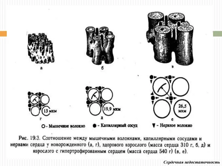 Сердечная недостаточность