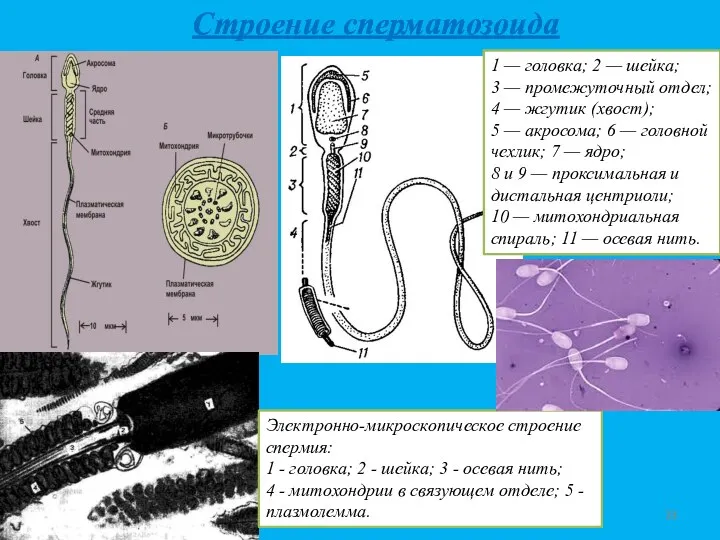 Строение сперматозоида 1 — головка; 2 — шейка; 3 —