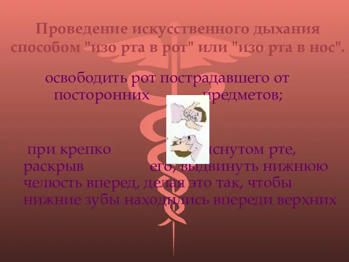 Проведение искусственного дыхания способом "изо рта в рот" или "изо рта в нос".