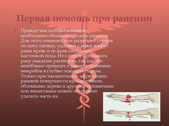 Первая помощь при ранении Прежде чем наложить повязку, необходимо обнажить область ранения. Для