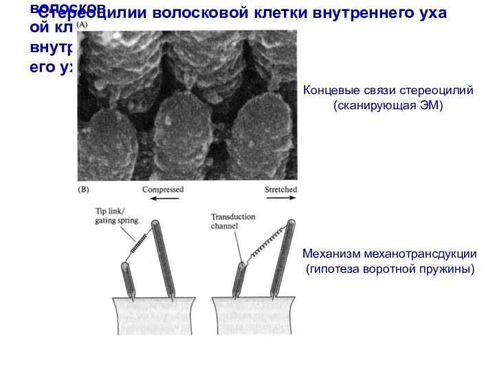 Стереоцилии волосковой клетки внутреннего уха Стереоцилии волосковой клетки внутреннего уха