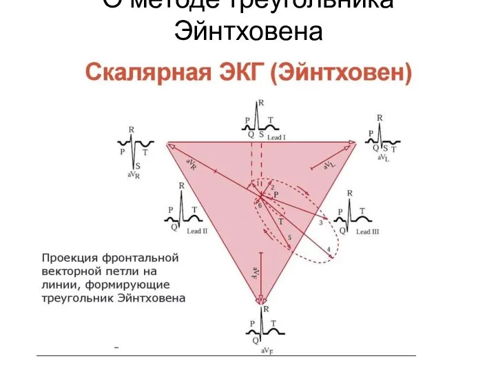 О методе треугольника Эйнтховена