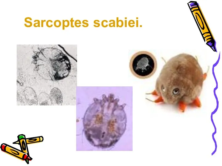 Sarcoptes scabiei.