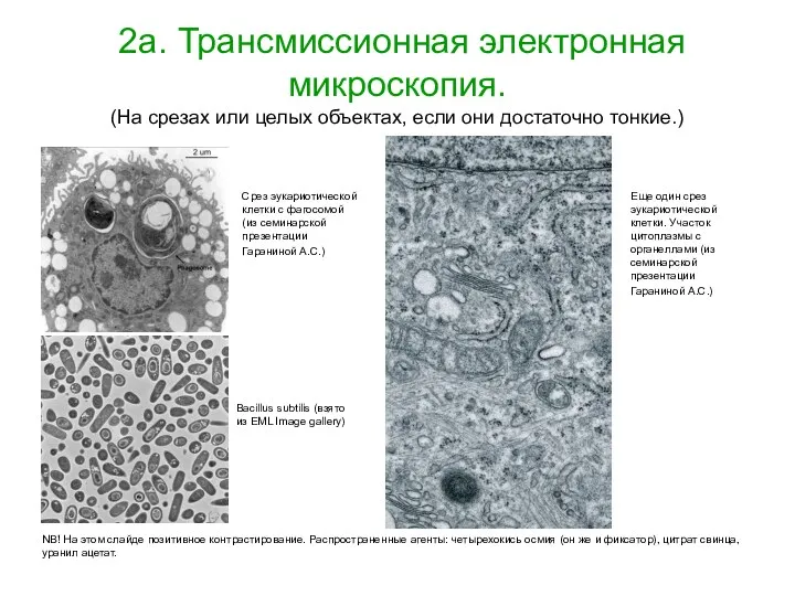 2а. Трансмиссионная электронная микроскопия. (На срезах или целых объектах, если