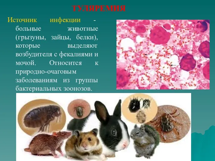 ТУЛЯРЕМИЯ Источник инфекции - больные животные (грызуны, зайцы, белки), которые