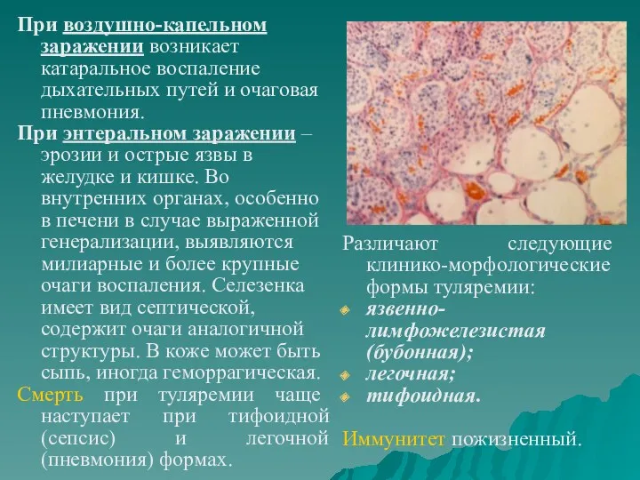 При воздушно-капельном заражении возникает катаральное воспаление дыхательных путей и очаговая