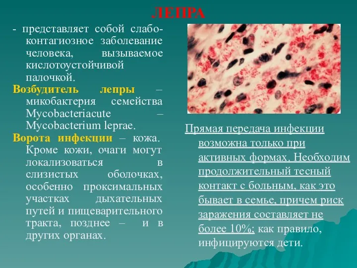 ЛЕПРА - представляет собой слабо-контагиозное заболевание человека, вызываемое кислотоустойчивой палочкой.