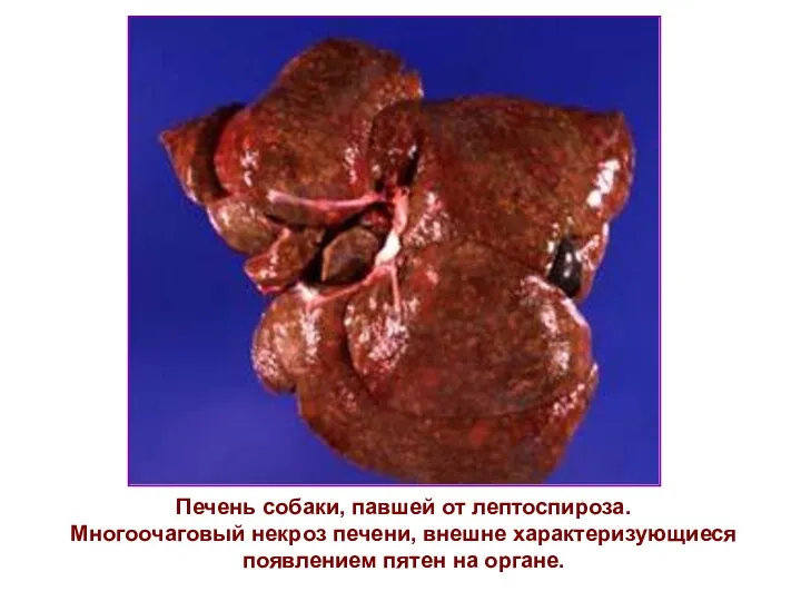 Печень собаки, павшей от лептоспироза. Многоочаговый некроз печени, внешне характеризующиеся появлением пятен на органе.