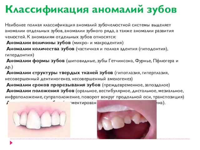 Классификация аномалий зубов Наиболее полная классификация аномалий зубочелюстной системы выделяет