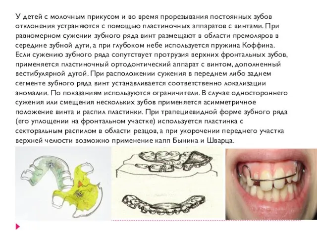 У детей с молочным прикусом и во время прорезывания постоянных