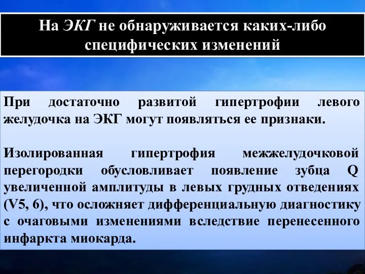 При достаточно развитой гипертрофии левого желудочка на ЭКГ могут появляться