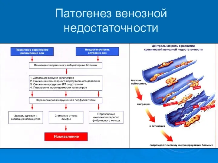 Патогенез венозной недостаточности