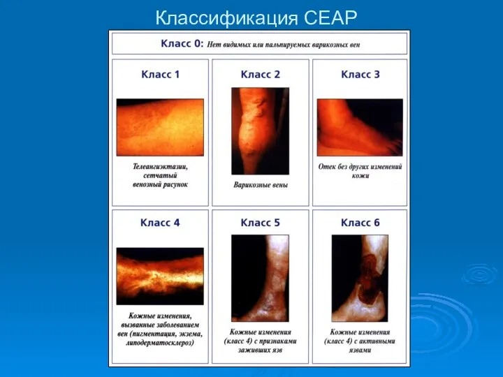 Классификация СЕАР