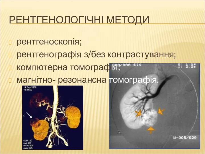 РЕНТГЕНОЛОГІЧНІ МЕТОДИ рентгеноскопія; рентгенографія з/без контрастування; компютерна томографія; магнітно- резонансна томографія.