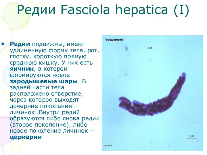 Редии Fasciola hepatica (I) Редии подвижны, имеют удлиненную форму тела,