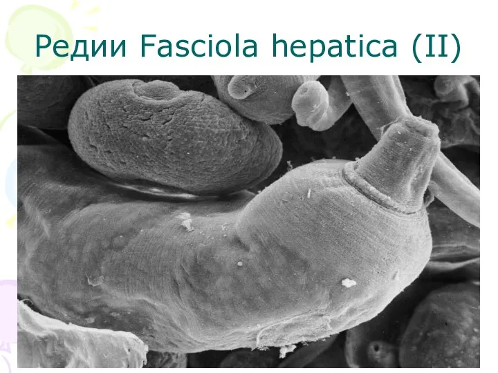 Редии Fasciola hepatica (II)