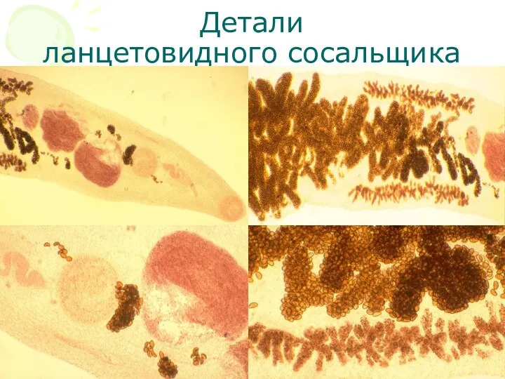 Детали ланцетовидного сосальщика