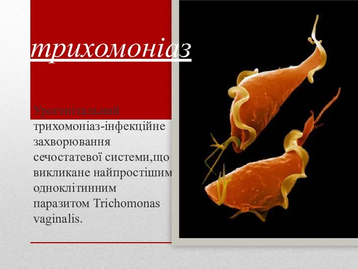 Урогенітальний трихомоніаз-інфекційне захворювання сечостатевої системи,що викликане найпростішим одноклітинним паразитом Trichomonas vaginalis. трихомоніаз