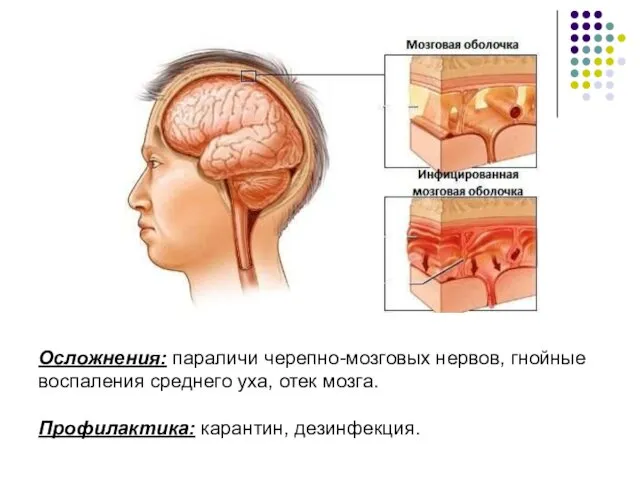 Осложнения: параличи черепно-мозговых нервов, гнойные воспаления среднего уха, отек мозга. Профилактика: карантин, дезинфекция.