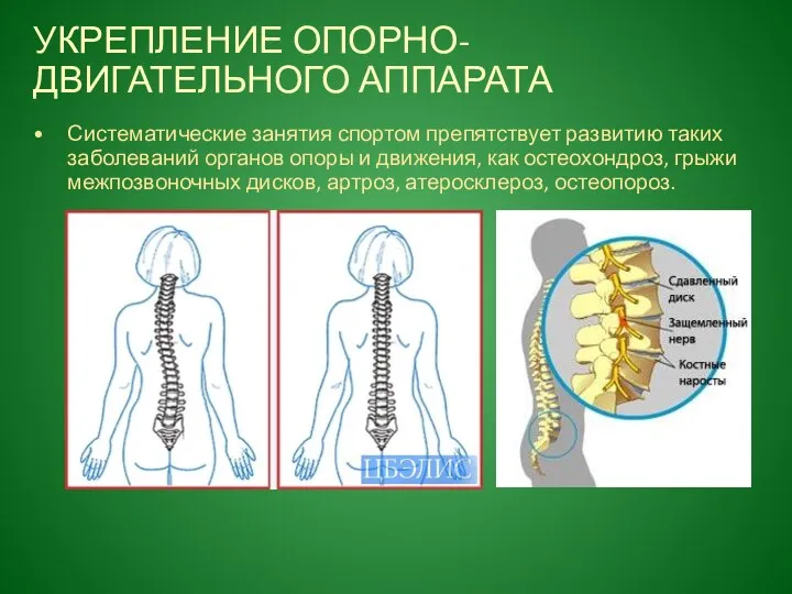 УКРЕПЛЕНИЕ ОПОРНО-ДВИГАТЕЛЬНОГО АППАРАТА Систематические занятия спортом препятствует развитию таких заболеваний