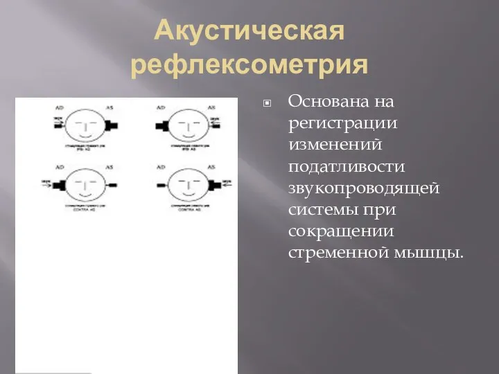 Акустическая рефлексометрия Основана на регистрации изменений податливости звукопроводящей системы при сокращении стременной мышцы.