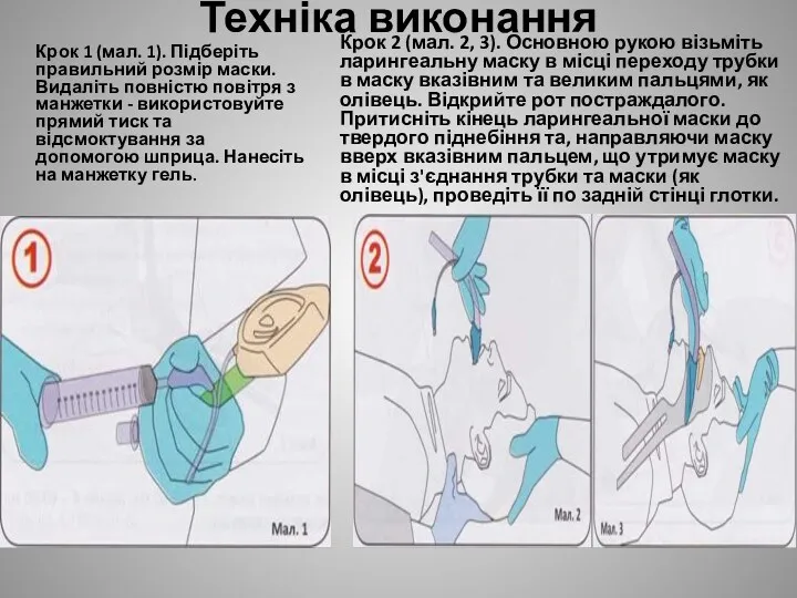 Техніка виконання Крок 1 (мал. 1). Підберіть правильний розмір маски.