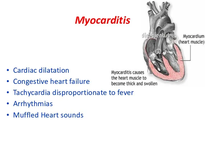 Myocarditis Cardiac dilatation Congestive heart failure Tachycardia disproportionate to fever Arrhythmias Muffled Heart sounds