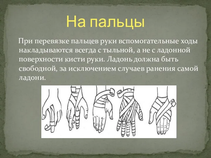 При перевязке пальцев руки вспомогательные ходы накладываются всегда с тыльной, а не с