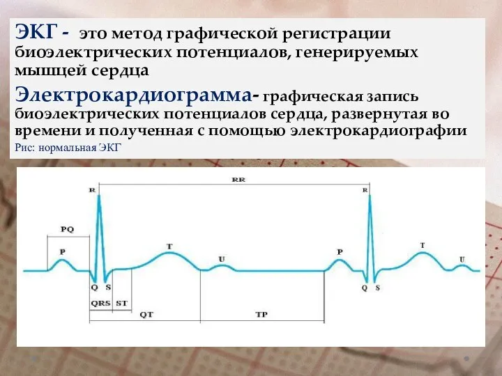 ЭКГ - это метод графической регистрации биоэлектрических потенциалов, генерируемых мышцей сердца Электрокардиограмма- графическая