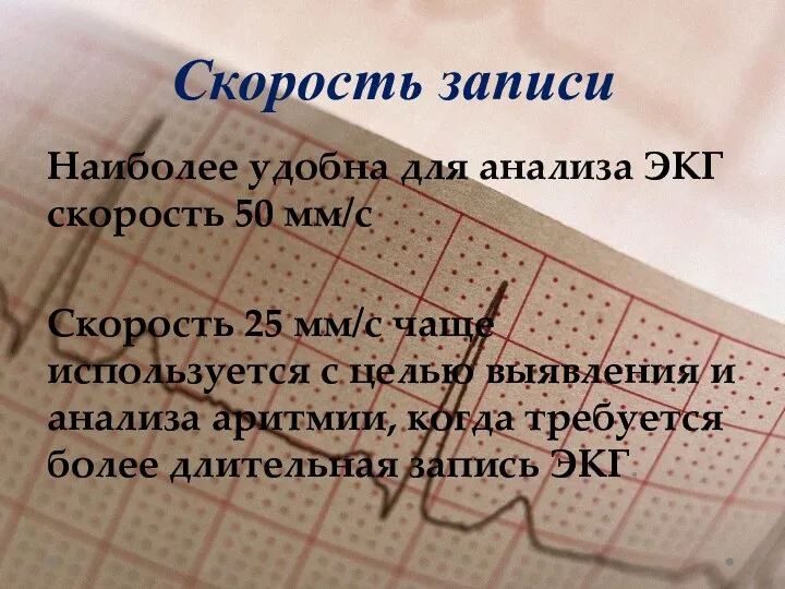 Скорость записи Наиболее удобна для анализа ЭКГ скорость 50 мм/с Скорость 25 мм/с