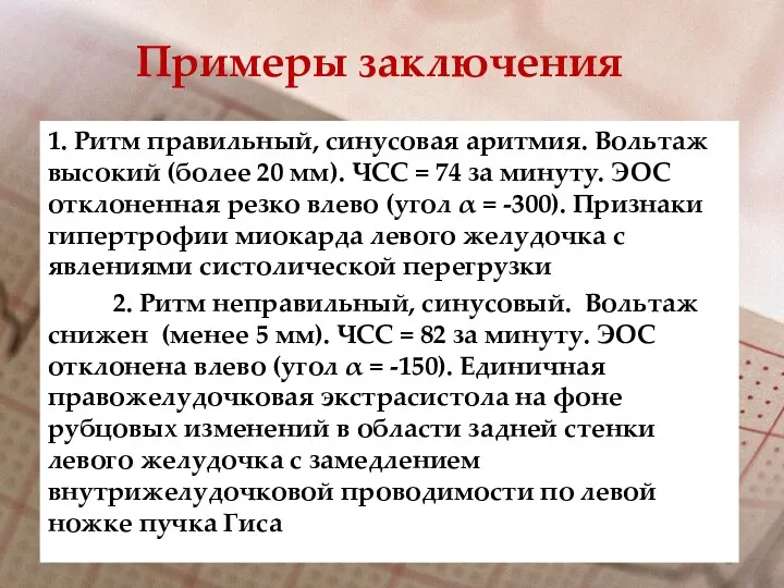 1. Ритм правильный, синусовая аритмия. Вольтаж высокий (более 20 мм). ЧСС = 74