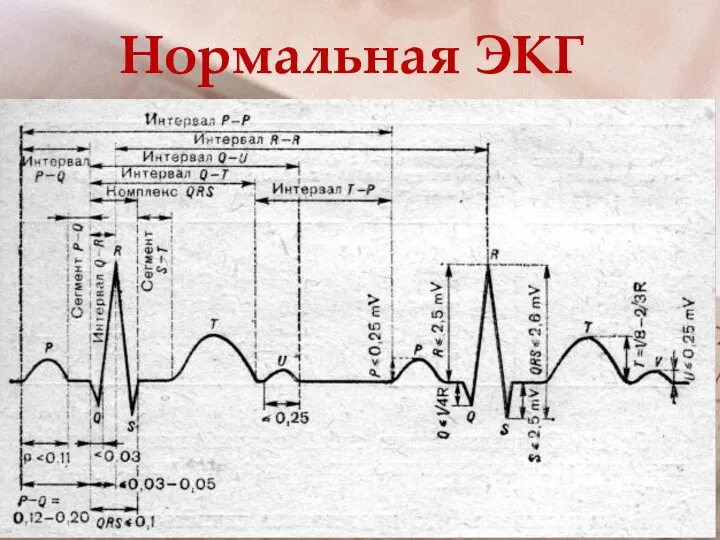 Нормальная ЭКГ