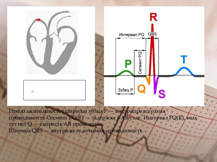 Продолжительность (ширина) зубца Р — внутрипредсердная проводимость Сегмент PQ(R) — задержка в АВ