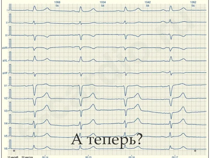 А теперь?