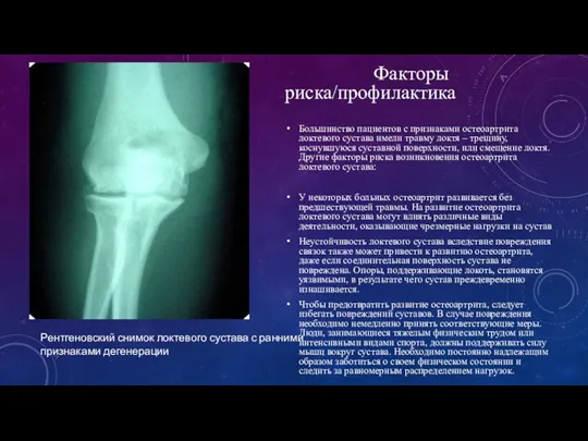 Факторы риска/профилактика Большинство пациентов с признаками остеоартрита локтевого сустава имели