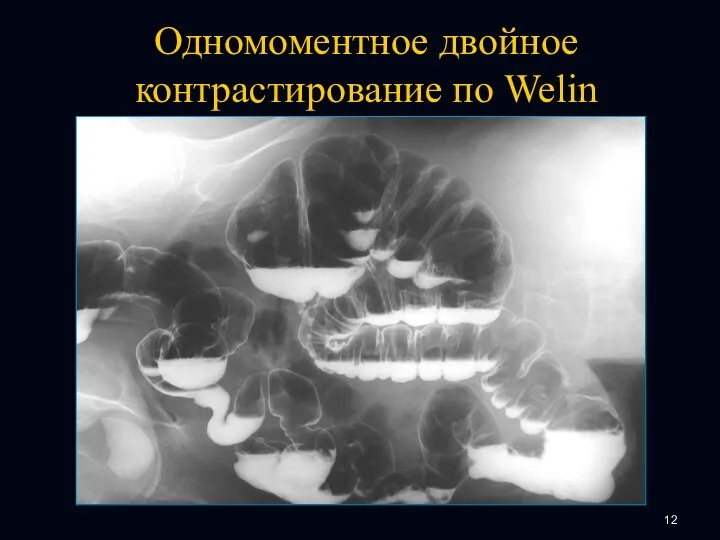 Одномоментное двойное контрастирование по Welin