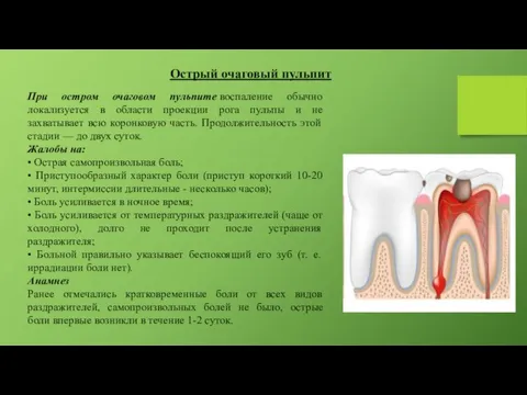 Острый очаговый пульпит При остром очаговом пульпите воспаление обычно локализуется