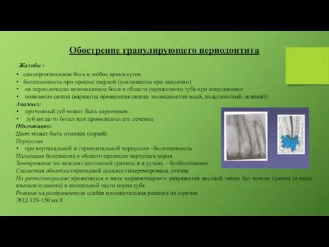 Обострение гранулирующего периодонтита Жалобы : самопроизвольная боль в любое время