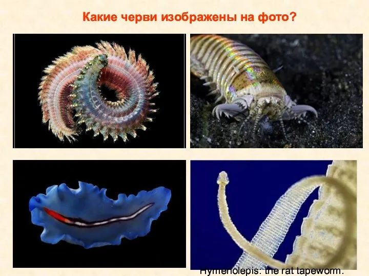 Какие черви изображены на фото? Hymenolepis: the rat tapeworm.