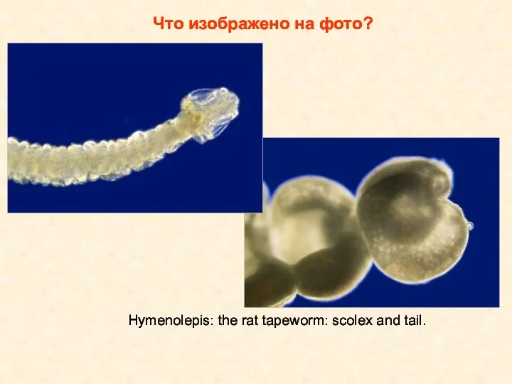Что изображено на фото? Hymenolepis: the rat tapeworm: scolex and tail.