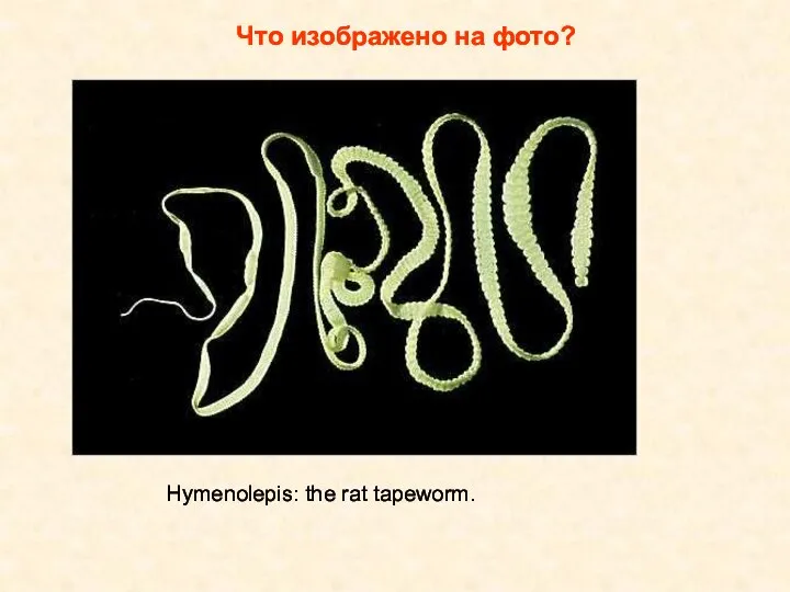 Что изображено на фото? Hymenolepis: the rat tapeworm.