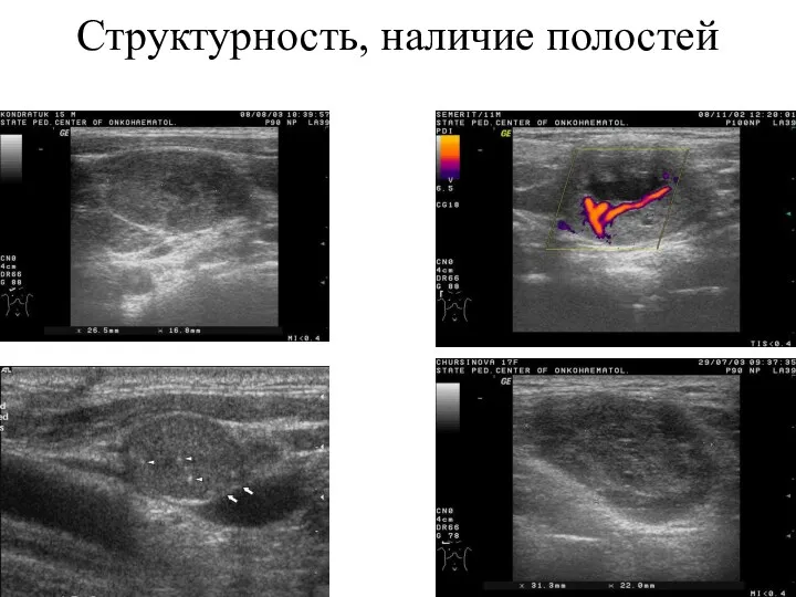 Структурность, наличие полостей