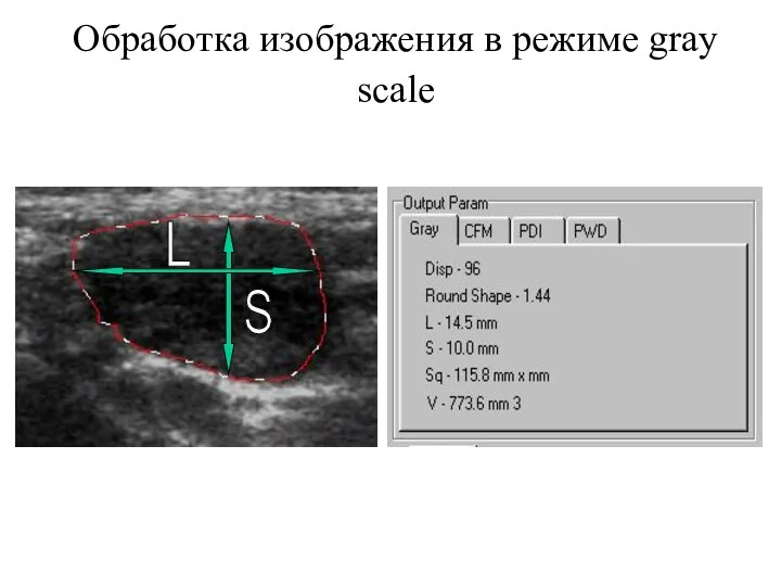 Обработка изображения в режиме gray scale L S
